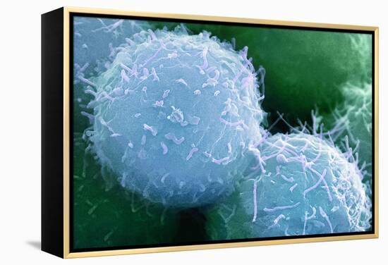 Embryonic Stem Cells, SEM-Science Photo Library-Framed Premier Image Canvas