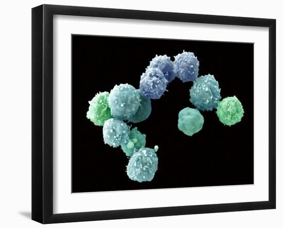 Embryonic Stem Cells, SEM-Steve Gschmeissner-Framed Photographic Print