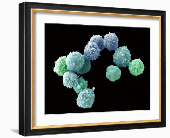 Embryonic Stem Cells, SEM-Steve Gschmeissner-Framed Photographic Print