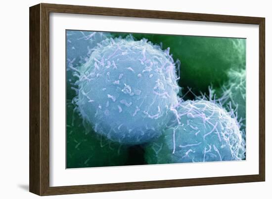 Embryonic Stem Cells, SEM-Science Photo Library-Framed Photographic Print