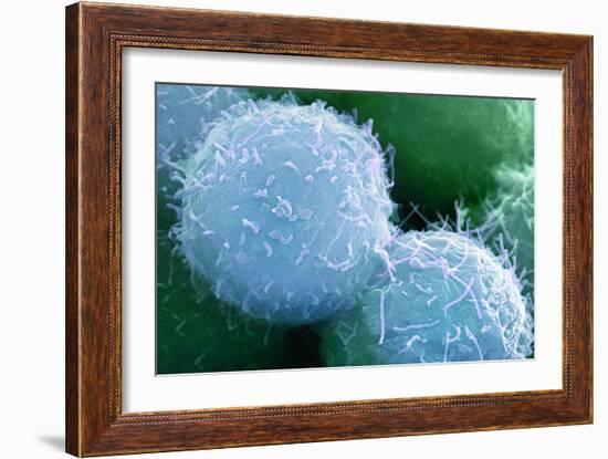 Embryonic Stem Cells, SEM-Science Photo Library-Framed Photographic Print