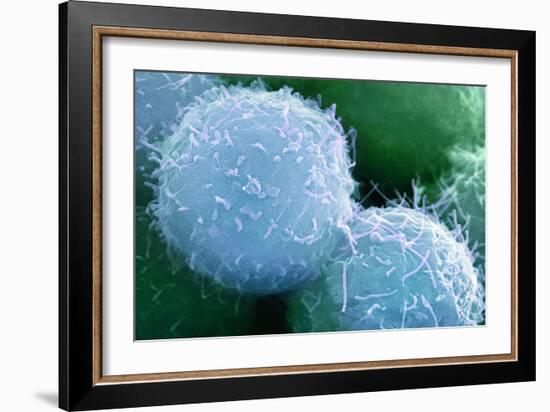 Embryonic Stem Cells, SEM-Science Photo Library-Framed Photographic Print