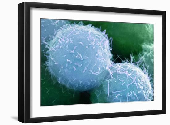 Embryonic Stem Cells, SEM-Science Photo Library-Framed Photographic Print