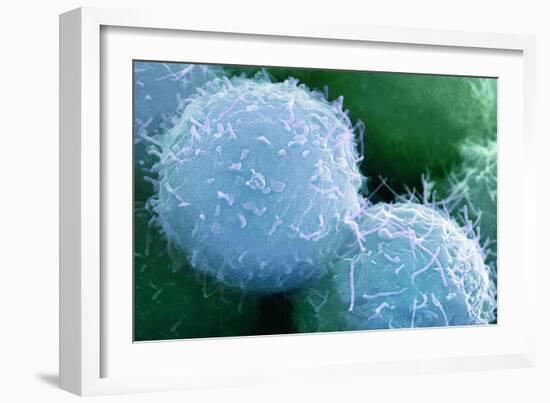 Embryonic Stem Cells, SEM-Science Photo Library-Framed Photographic Print