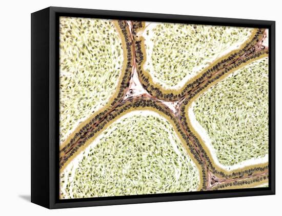 Epididymis, Light Micrograph-Steve Gschmeissner-Framed Premier Image Canvas