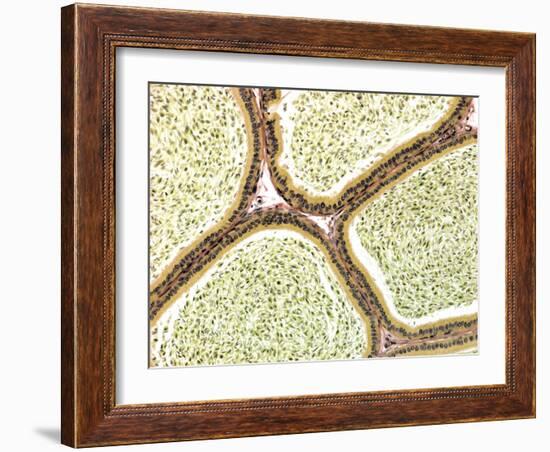 Epididymis, Light Micrograph-Steve Gschmeissner-Framed Photographic Print