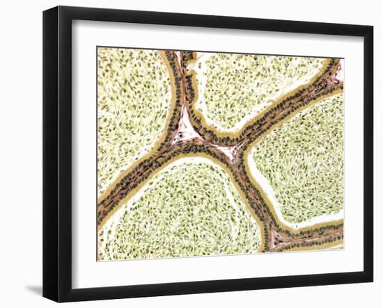 Epididymis, Light Micrograph-Steve Gschmeissner-Framed Photographic Print