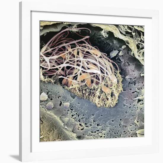 Epididymis, SEM-Steve Gschmeissner-Framed Photographic Print