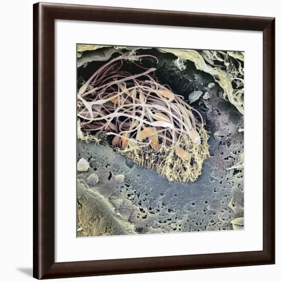 Epididymis, SEM-Steve Gschmeissner-Framed Photographic Print