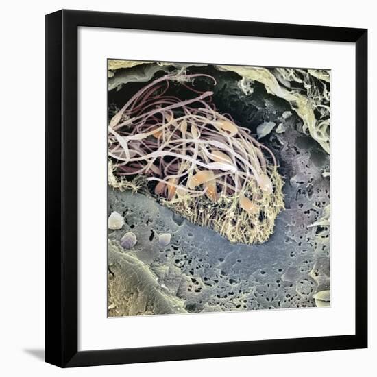 Epididymis, SEM-Steve Gschmeissner-Framed Photographic Print