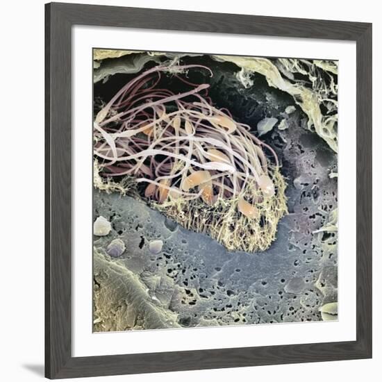 Epididymis, SEM-Steve Gschmeissner-Framed Photographic Print