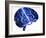 Epilepsy-John Bavosi-Framed Photographic Print