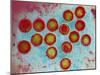 Epstein-Barr Virus Particles-null-Mounted Photographic Print