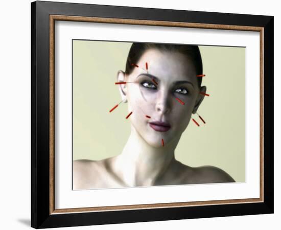 Facial Acupuncture, Artwork-Christian Darkin-Framed Photographic Print