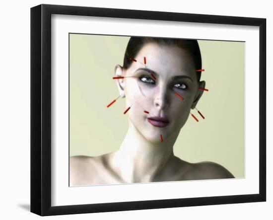 Facial Acupuncture, Artwork-Christian Darkin-Framed Photographic Print