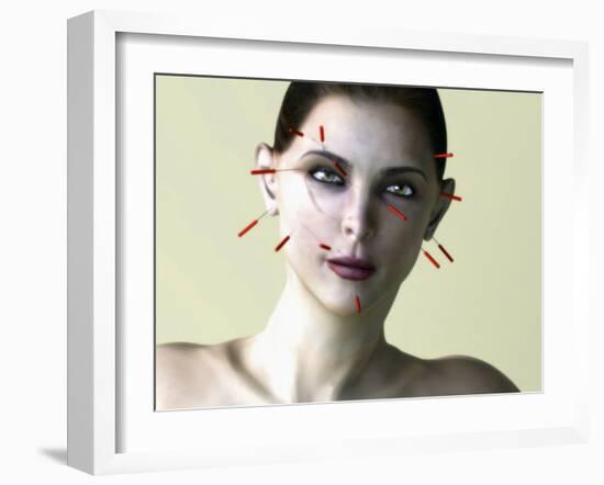 Facial Acupuncture, Artwork-Christian Darkin-Framed Photographic Print