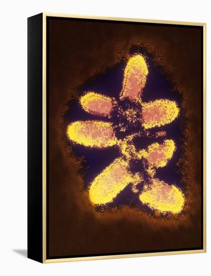 False-col TEM of Rabies Virus Particles-null-Framed Premier Image Canvas