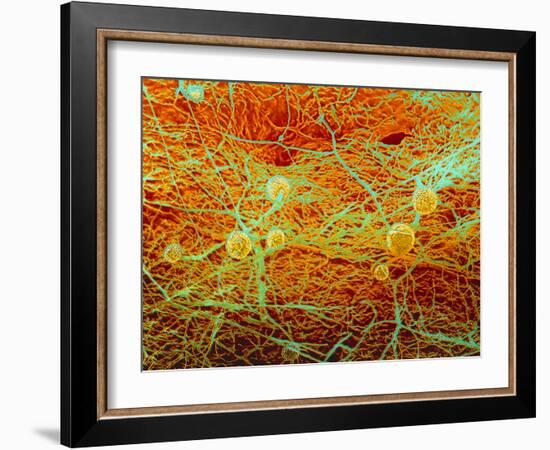 False-colour SEM of Bread Mould-Dr. Jeremy Burgess-Framed Photographic Print