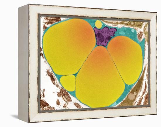 Fat Cell, TEM-Steve Gschmeissner-Framed Premier Image Canvas