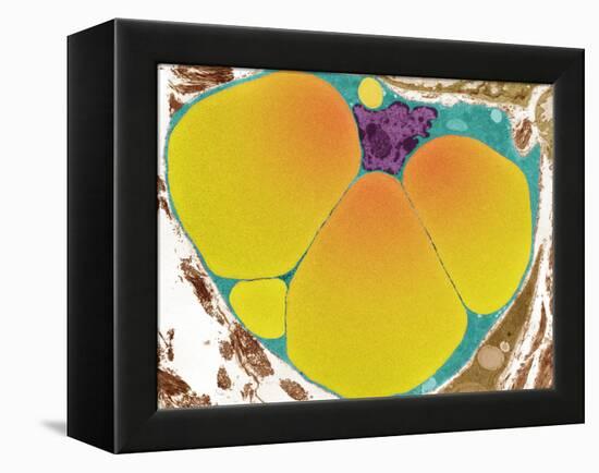 Fat Cell, TEM-Steve Gschmeissner-Framed Premier Image Canvas