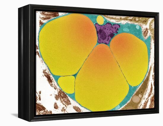 Fat Cell, TEM-Steve Gschmeissner-Framed Premier Image Canvas