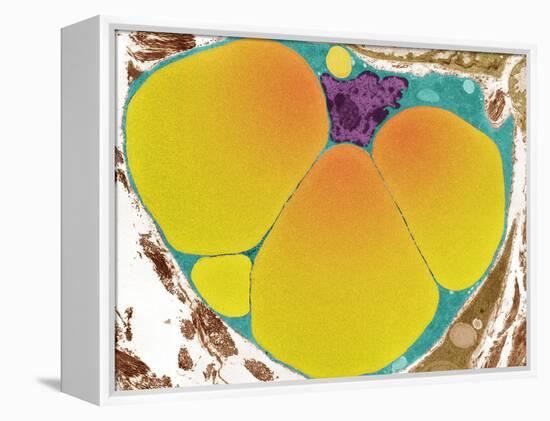 Fat Cell, TEM-Steve Gschmeissner-Framed Premier Image Canvas