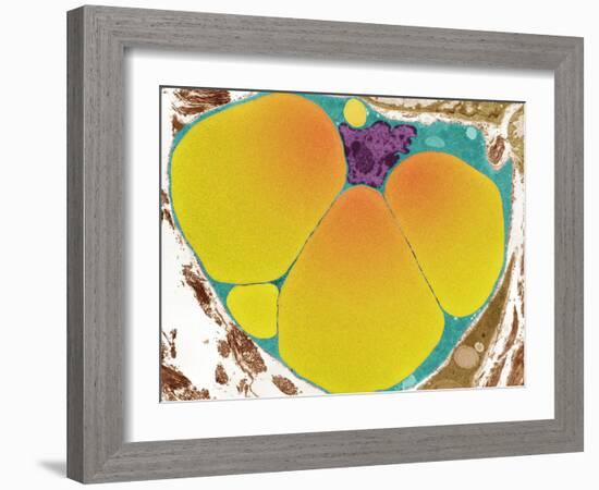 Fat Cell, TEM-Steve Gschmeissner-Framed Photographic Print