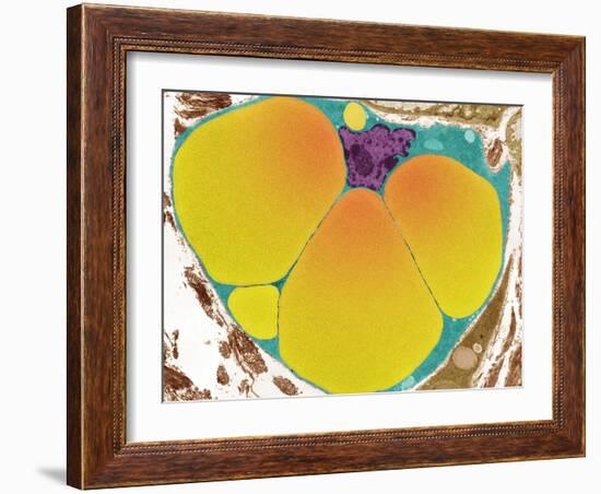 Fat Cell, TEM-Steve Gschmeissner-Framed Photographic Print