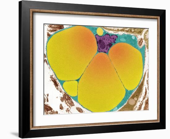 Fat Cell, TEM-Steve Gschmeissner-Framed Photographic Print