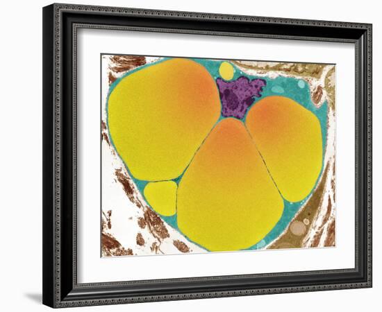 Fat Cell, TEM-Steve Gschmeissner-Framed Photographic Print