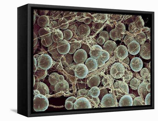 Fat Cells, SEM-Steve Gschmeissner-Framed Premier Image Canvas