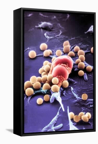 Fat Cells, SEM-Science Photo Library-Framed Premier Image Canvas