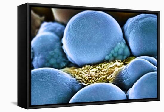 Fat Cells, SEM-Science Photo Library-Framed Premier Image Canvas