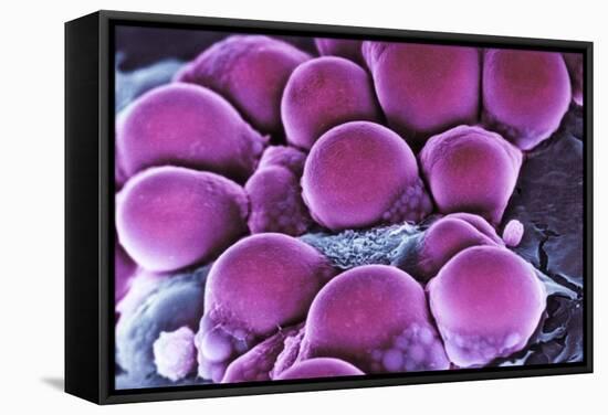 Fat Cells, SEM-Science Photo Library-Framed Premier Image Canvas