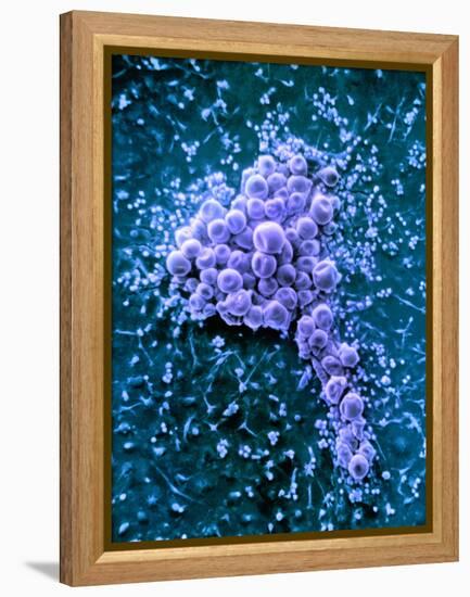 Fat Cells, SEM-Science Photo Library-Framed Premier Image Canvas