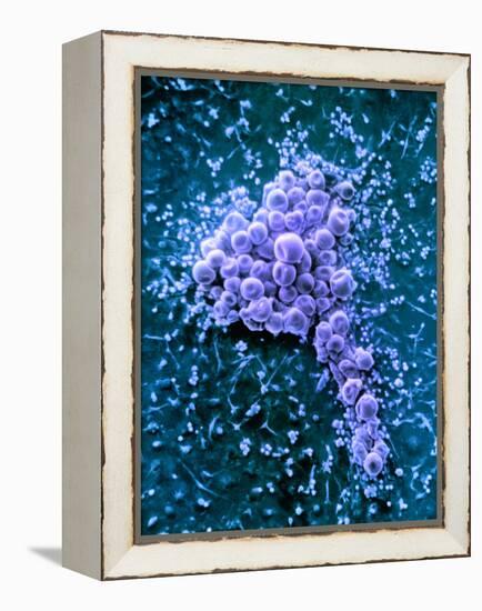 Fat Cells, SEM-Science Photo Library-Framed Premier Image Canvas