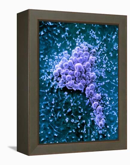 Fat Cells, SEM-Science Photo Library-Framed Premier Image Canvas