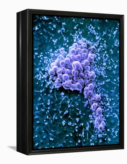 Fat Cells, SEM-Science Photo Library-Framed Premier Image Canvas