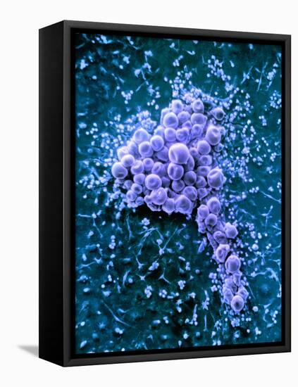 Fat Cells, SEM-Science Photo Library-Framed Premier Image Canvas