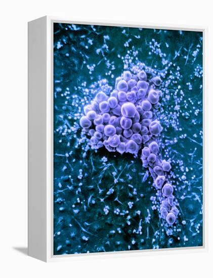 Fat Cells, SEM-Science Photo Library-Framed Premier Image Canvas