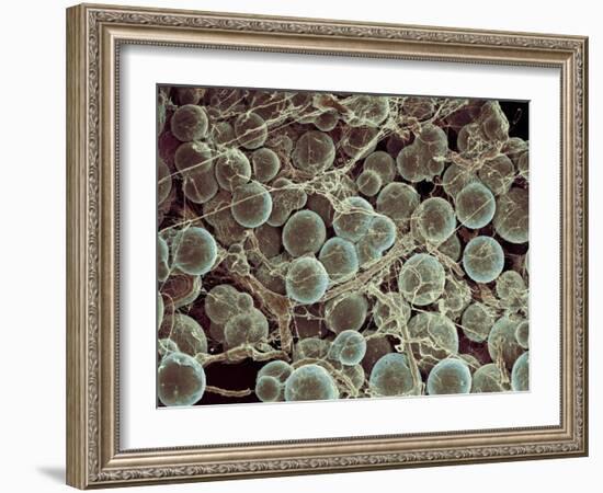 Fat Cells, SEM-Steve Gschmeissner-Framed Photographic Print