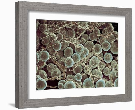 Fat Cells, SEM-Steve Gschmeissner-Framed Photographic Print