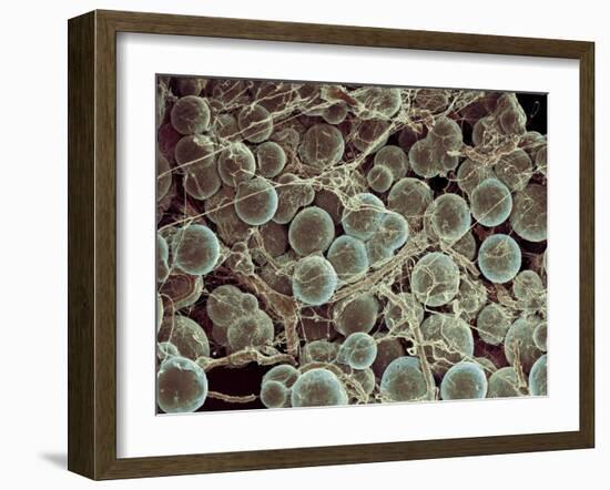 Fat Cells, SEM-Steve Gschmeissner-Framed Photographic Print