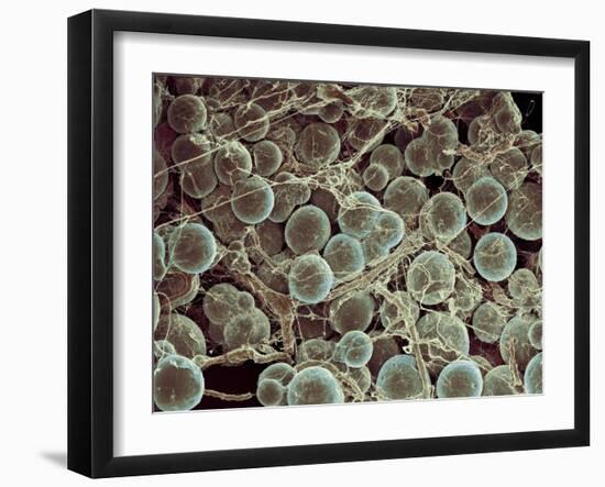 Fat Cells, SEM-Steve Gschmeissner-Framed Photographic Print