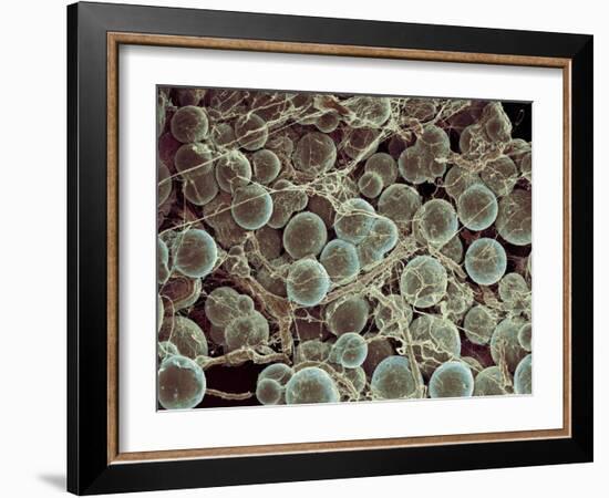 Fat Cells, SEM-Steve Gschmeissner-Framed Photographic Print