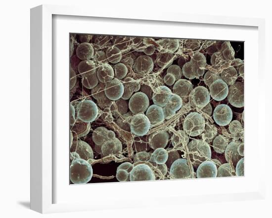 Fat Cells, SEM-Steve Gschmeissner-Framed Photographic Print