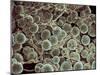 Fat Cells, SEM-Steve Gschmeissner-Mounted Photographic Print