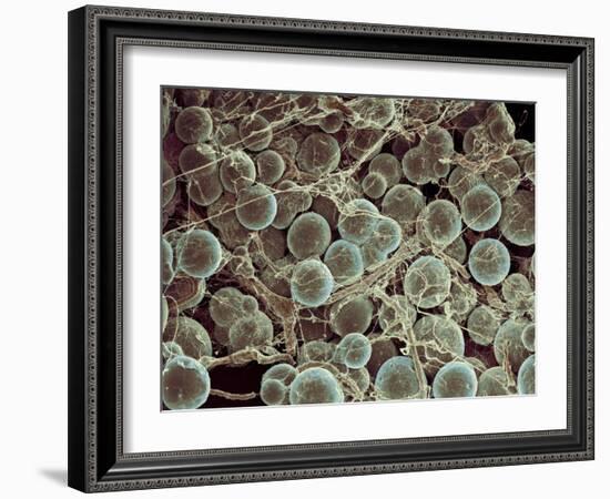 Fat Cells, SEM-Steve Gschmeissner-Framed Photographic Print