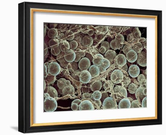 Fat Cells, SEM-Steve Gschmeissner-Framed Photographic Print