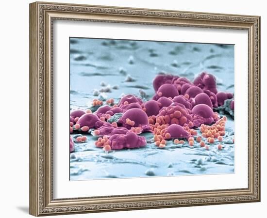 Fat Cells, SEM-Science Photo Library-Framed Photographic Print